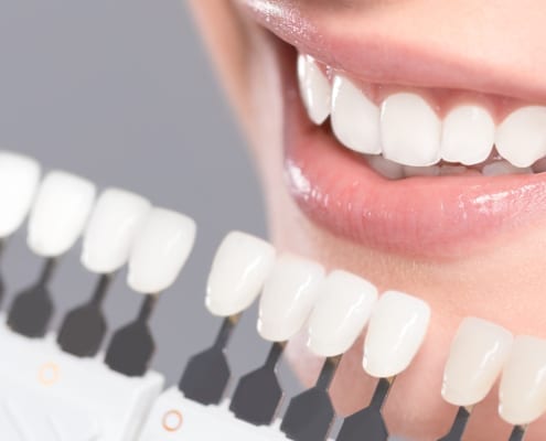Cosmetic Dentistry | Lasry Dental Clinic