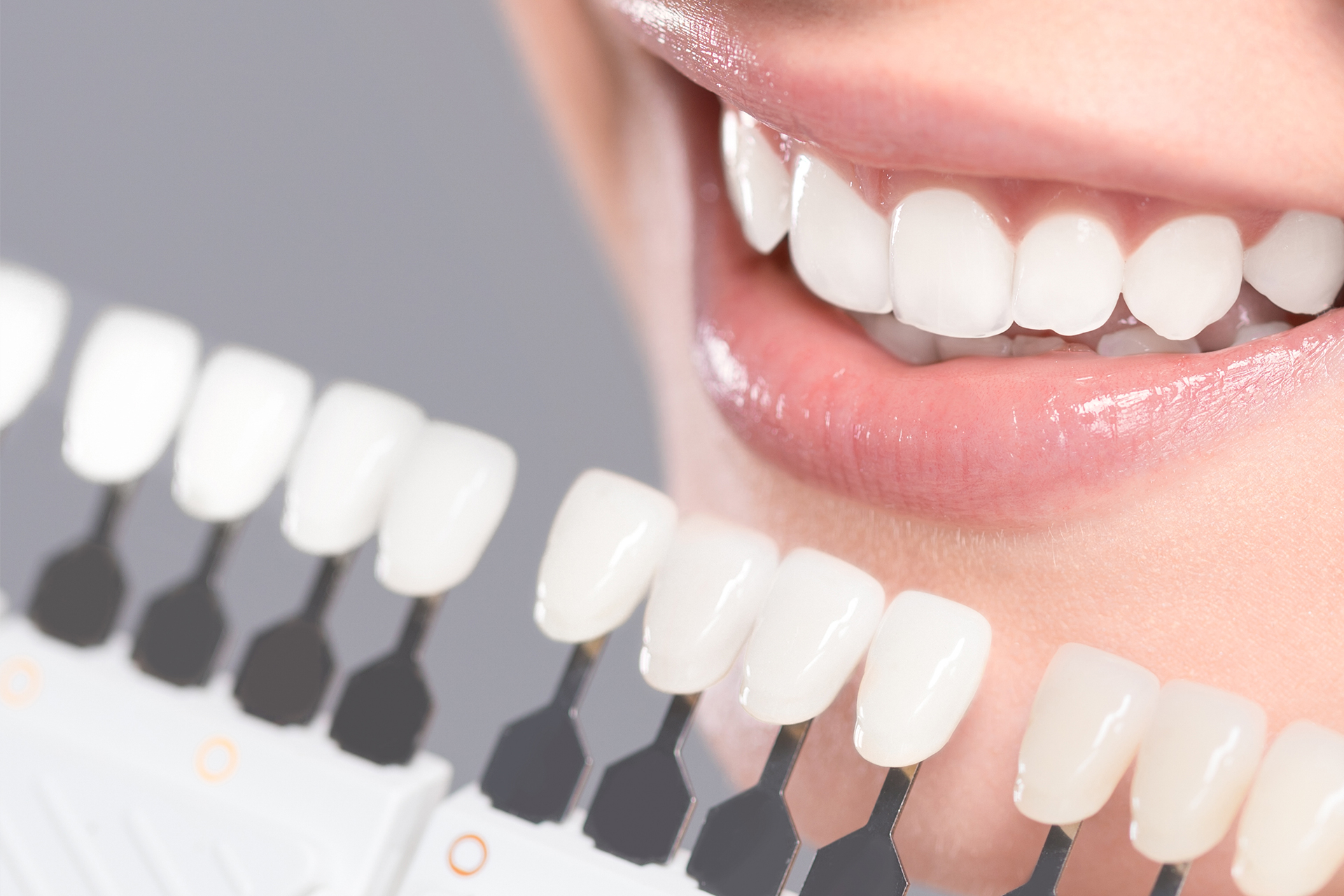 Cosmetic Dentistry | Lasry Dental Clinic