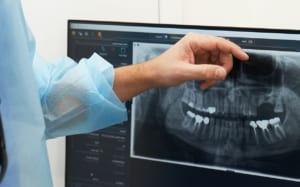 Panorex and 3 D X-Ray | Lasry Dental Clinic