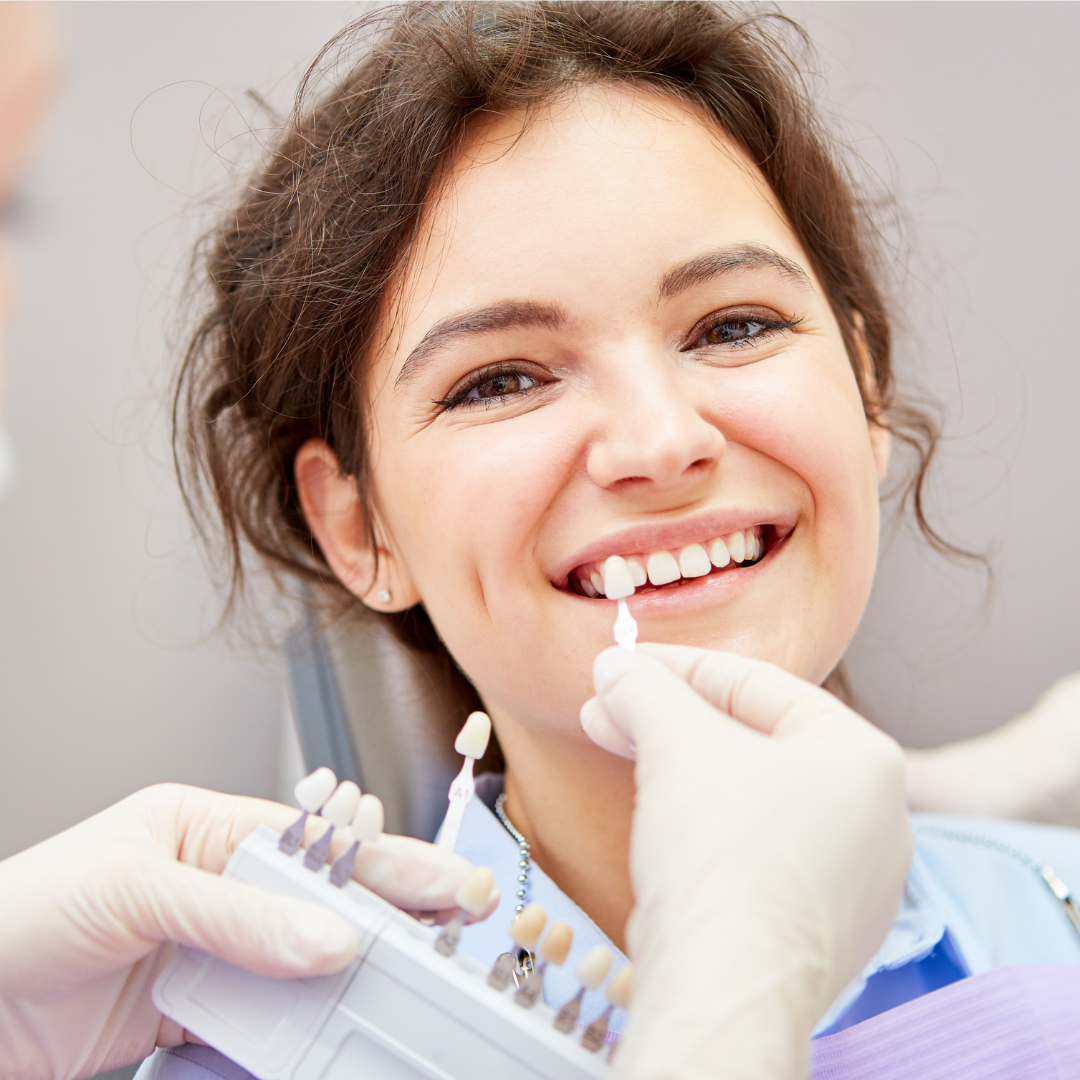 Veneers-Lasry-Dental-Clinic-5