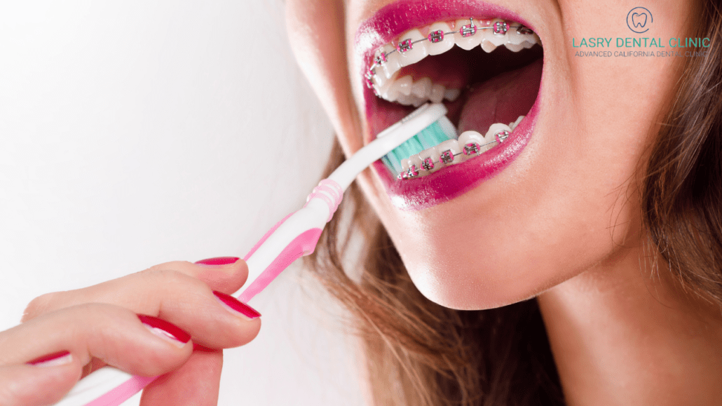 how to keep teeth clean with braces