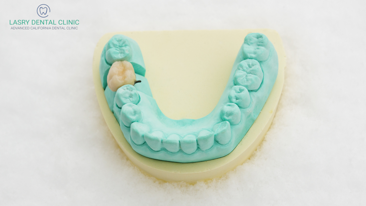 what-is-a-dental-crown