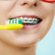 how-to-brush-your-teeth-with-braces