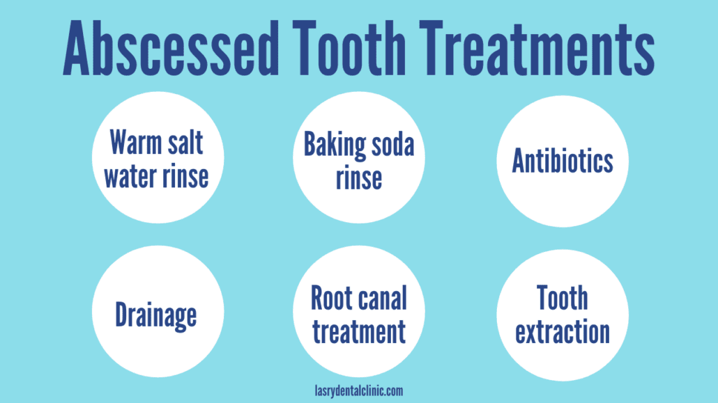 abscessed-tooth-treatment