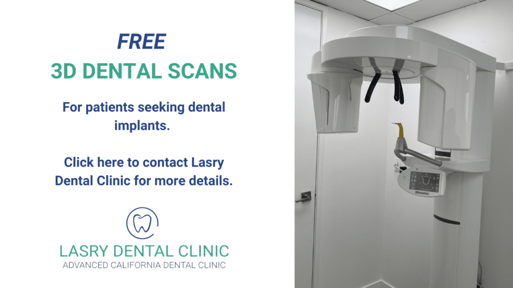 FREE-3d-dental-scan