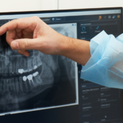 how-often-should-you-get-x-rays-at-the-dentist