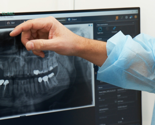 how-often-should-you-get-x-rays-at-the-dentist