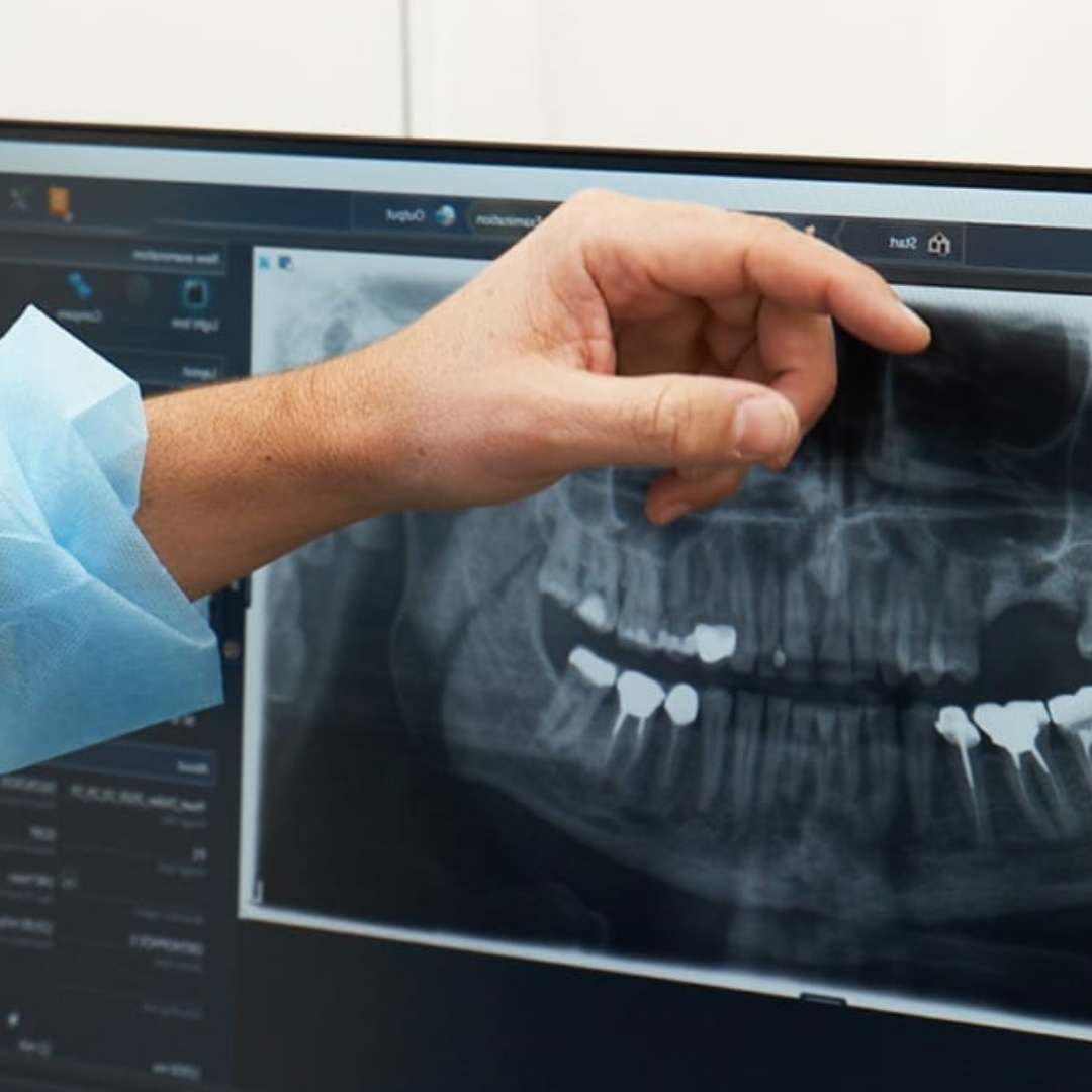 Digital-dentistry-Lasry-Dental-Clinic-2