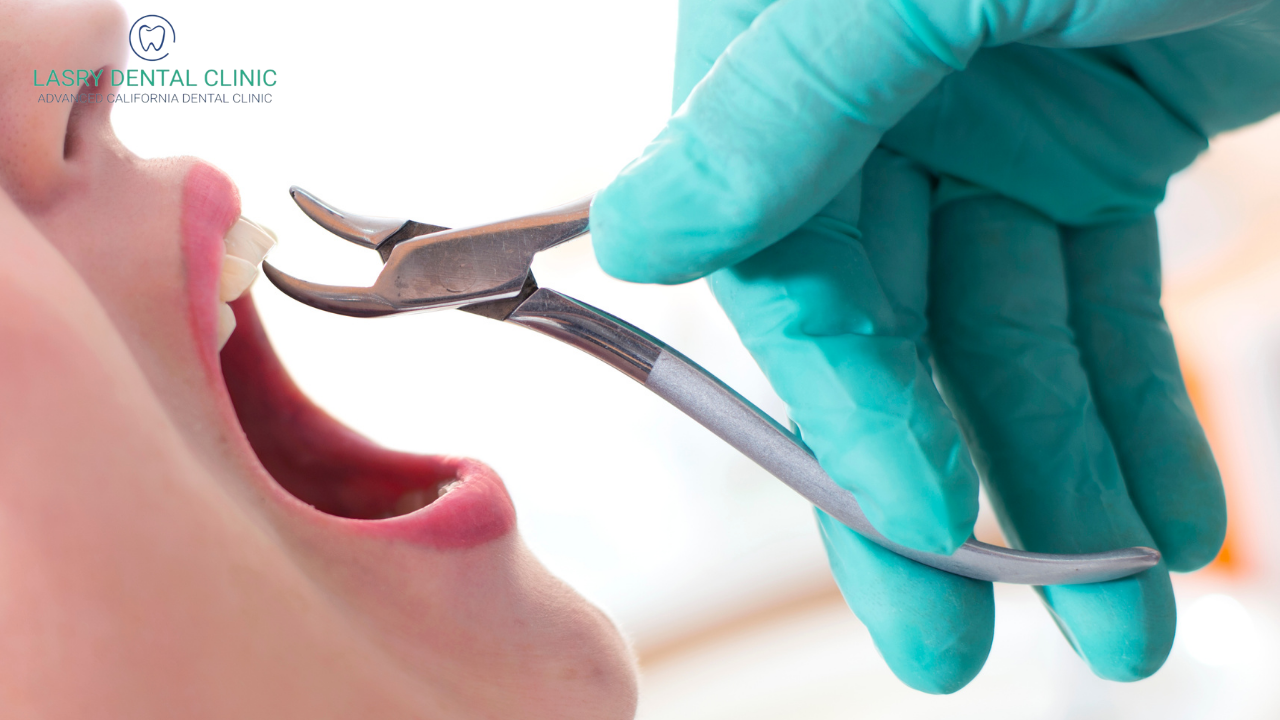 tooth-extraction-cost 