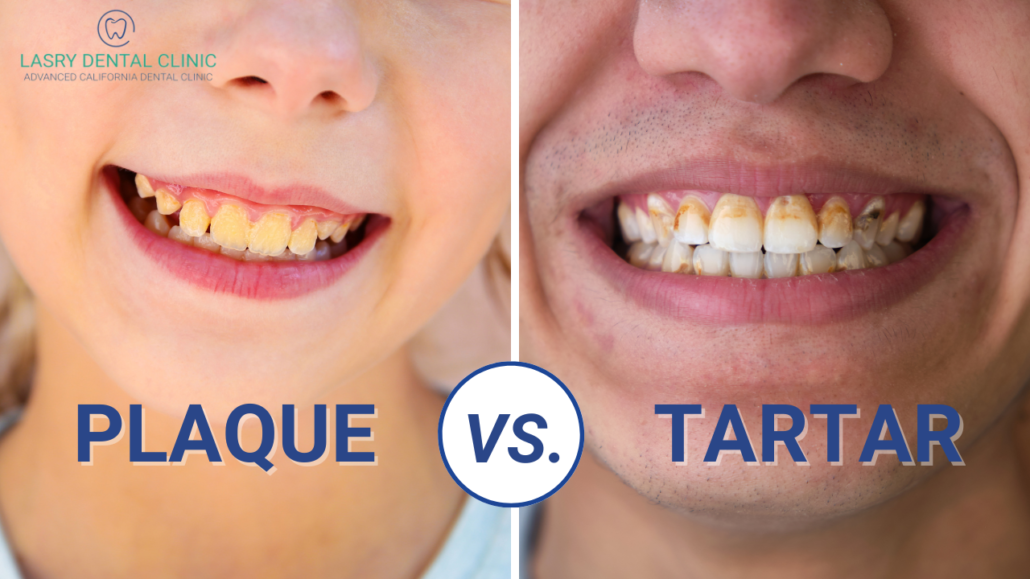 Plaque vs. Tartar: What's the Difference?