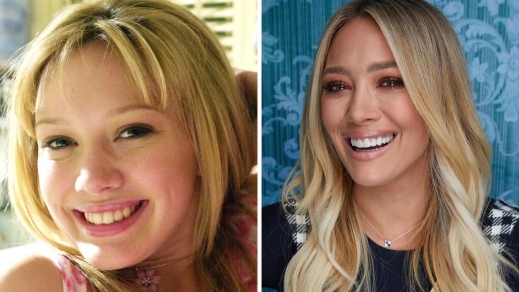 Hilary Duff before and after porcelain veneers