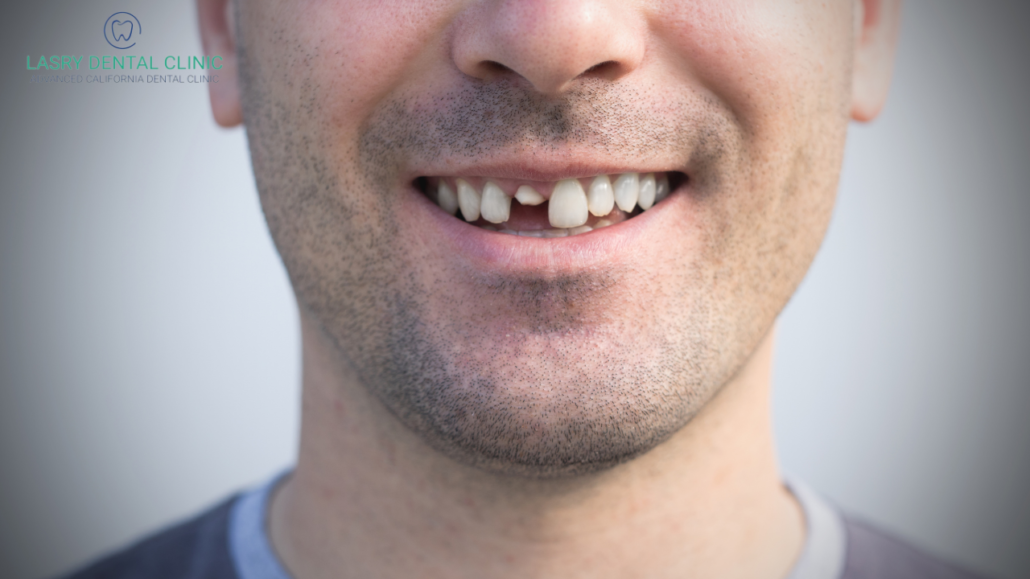 man with front tooth missing