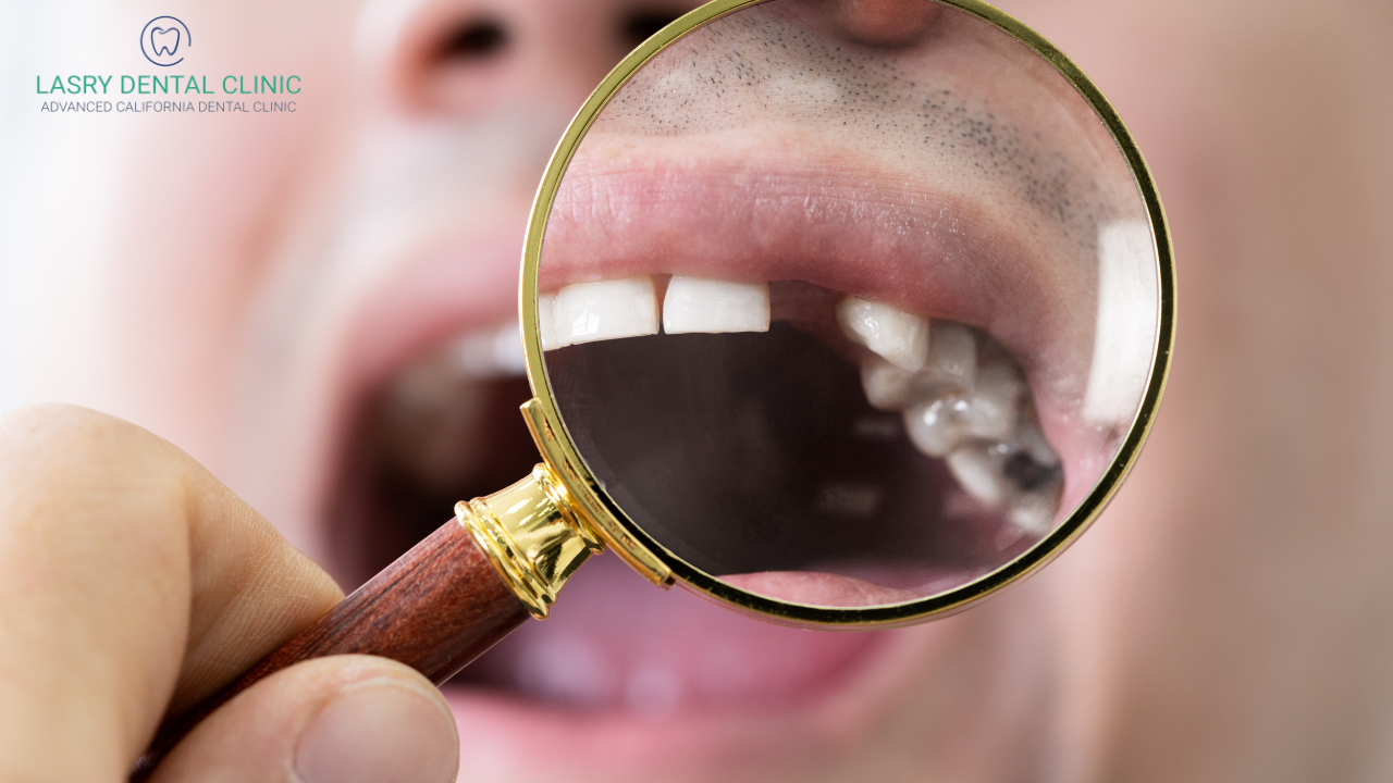 magnifying class showing missing teeth